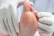 علت احساس درد و گرما در کف پا چیست؟