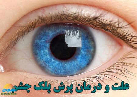 شایع ترین علل پرش چشم