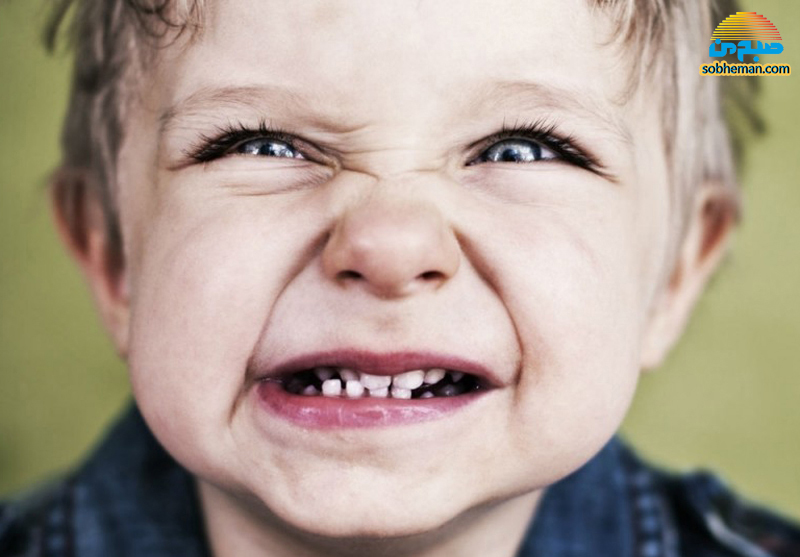 دندان قروچه کودکان؛ از علت تا درمان