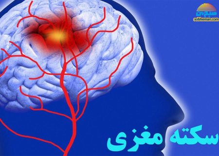 سکته مغزی؛ از چیستی تا چرایی