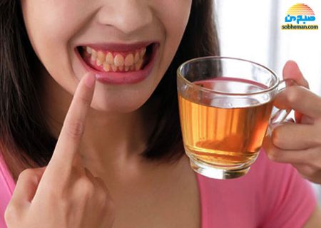نوشیدن چای چه اثری بر دندان‌های شما دارد؟