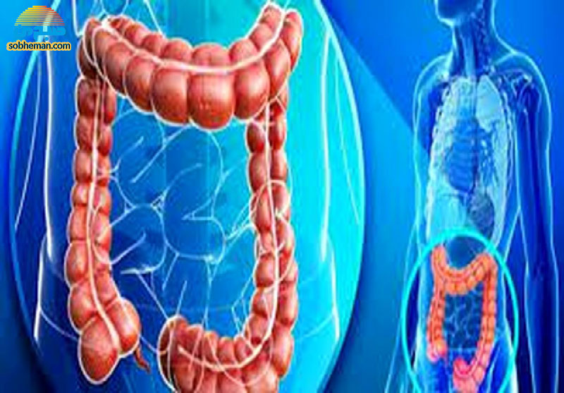 (اینفوگرافیک) راهکارهایی برای افزایش سلامت روده