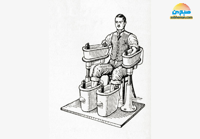 (عکس) درمان عجیب قرن نوزدهمی آرتریت روماتوئید