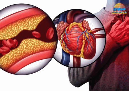 طب سنتی و روش های درمان گرفتگی رگ قلب